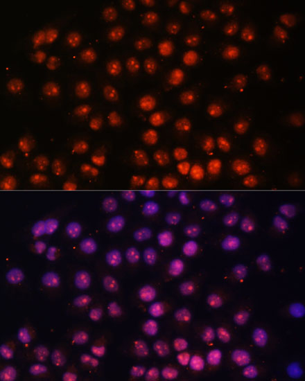 Immunofluorescence analysis of HeLa cells using TFEB Polyclonal Antibody at dilution of  1:100. Blue: DAPI for nuclear staining.