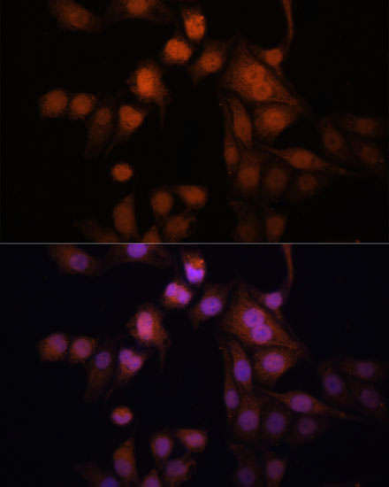 Immunofluorescence analysis of HeLa cells using Twist Polyclonal Antibody at dilution of  1:100. Blue: DAPI for nuclear staining.
