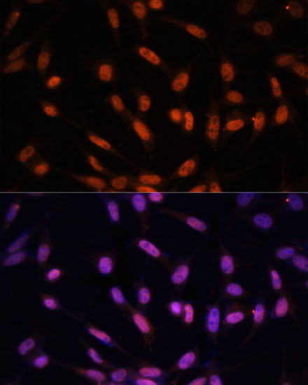 Immunofluorescence analysis of NIH/3T3 cells using Twist Polyclonal Antibody at dilution of  1:100. Blue: DAPI for nuclear staining.