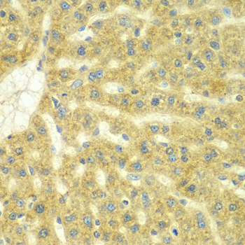 Immunohistochemistry of paraffin-embedded Rat liver using ADCK3 Polyclonal Antibody at dilution of  1:100 (40x lens).