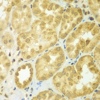 Immunohistochemistry of paraffin-embedded Human kidney using ADCK3 Polyclonal Antibody at dilution of  1:100 (40x lens).