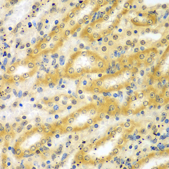 Immunohistochemistry of paraffin-embedded Mouse kidney using ADCK3 Polyclonal Antibody at dilution of  1:100 (40x lens).