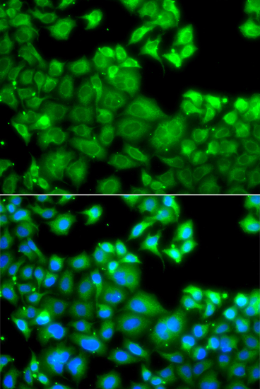 Immunofluorescence analysis of A549 cells using NLRC4 Polyclonal Antibody
