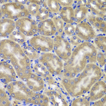 Immunohistochemistry of paraffin-embedded Mouse kidney using NLRC4 Polyclonal Antibody at dilution of  1:100 (40x lens).