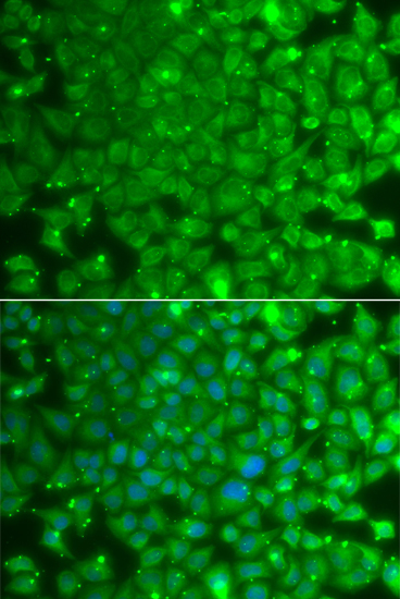 Immunofluorescence analysis of A549 cells using KBTBD7 Polyclonal Antibody