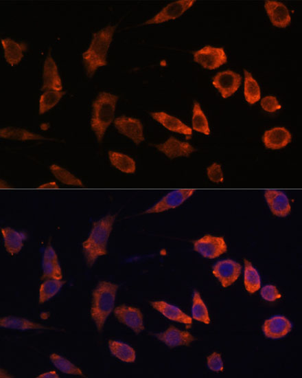 Immunofluorescence analysis of L929 cells using RAB5B Polyclonal Antibody at dilution of  1:100. Blue: DAPI for nuclear staining.