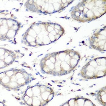 Immunohistochemistry of paraffin-embedded Human colon using SH3GLB2 Polyclonal Antibody at dilution of  1:200 (40x lens).