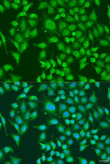 Immunofluorescence analysis of U2OS cells using CENPQ Polyclonal Antibody at dilution of  1:100. Blue: DAPI for nuclear staining.