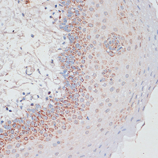 Immunohistochemistry of paraffin-embedded Human tonsil using Desmoplakin Polyclonal Antibody at dilution of  1:100 (40x lens).