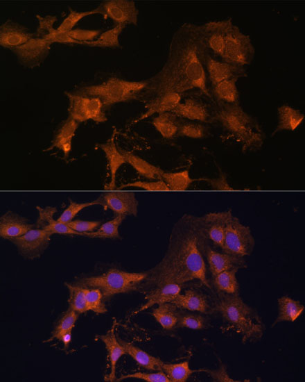 Immunofluorescence analysis of C6 cells using MAP2K3 Polyclonal Antibody at dilution of  1:100. Blue: DAPI for nuclear staining.