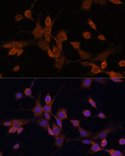 Immunofluorescence analysis of NIH/3T3 cells using MAP2K3 Polyclonal Antibody at dilution of  1:100. Blue: DAPI for nuclear staining.