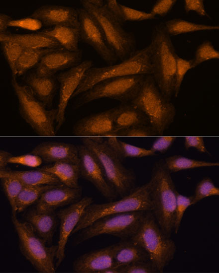 Immunofluorescence analysis of U-2 OS cells using MAP2K3 Polyclonal Antibody at dilution of  1:100. Blue: DAPI for nuclear staining.