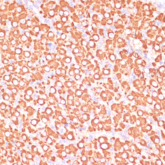Immunohistochemistry of paraffin-embedded Rat ovary using MAP2K3 Polyclonal Antibody at dilution of  1:100 (40x lens).