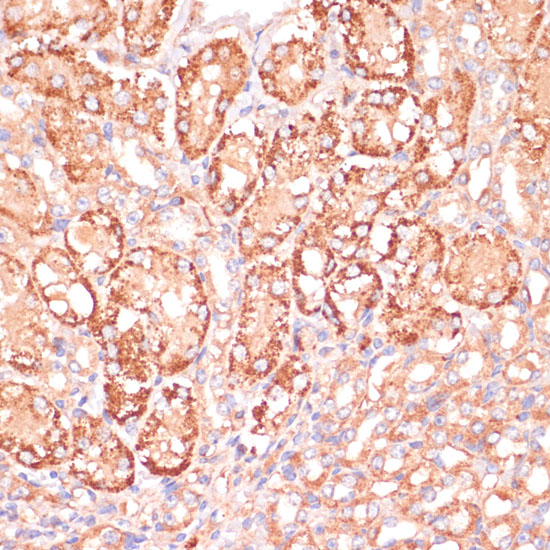 Immunohistochemistry of paraffin-embedded Mouse kidney using MAP2K3 Polyclonal Antibody at dilution of  1:100 (40x lens).