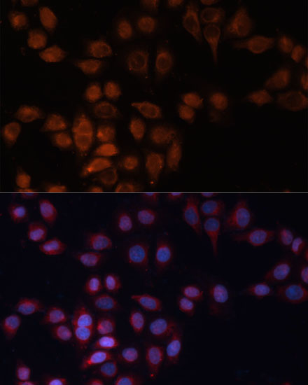 Immunofluorescence analysis of HeLa cells using ADAM15 Polyclonal Antibody at dilution of  1:100 (40x lens). Blue: DAPI for nuclear staining.