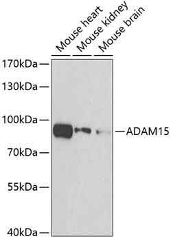 Western blot analysis of extracts of various cell lines using ADAM15 Polyclonal Antibody at dilution of 1:500.