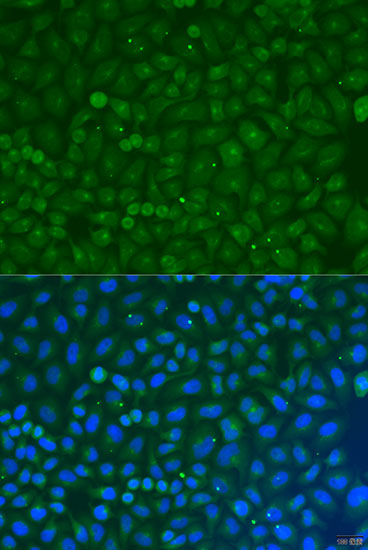 Immunofluorescence analysis of U2OS cells using COG4 Polyclonal Antibody at dilution of  1:100. Blue: DAPI for nuclear staining.