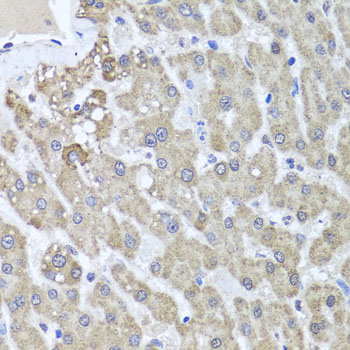 Immunohistochemistry of paraffin-embedded Human liver damage using ALKBH4 Polyclonal Antibody at dilution of  1:100 (40x lens).