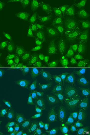 Immunofluorescence analysis of U2OS cells using PLCD4 Polyclonal Antibody at dilution of  1:100. Blue: DAPI for nuclear staining.