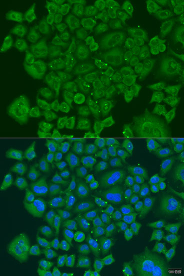 Immunofluorescence analysis of U2OS cells using NDUFS7 Polyclonal Antibody at dilution of  1:100. Blue: DAPI for nuclear staining.