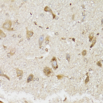 Immunohistochemistry of paraffin-embedded Mouse brain using NDUFS7 Polyclonal Antibody at dilution of  1:100 (40x lens).