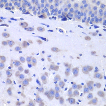 Immunohistochemistry of paraffin-embedded Rat brain using HTT Polyclonal Antibody at dilution of  1:100 (40x lens).