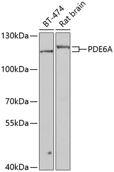 Western blot analysis of extracts of various cell lines using PDE6A Polyclonal Antibody at dilution of 1:1000.