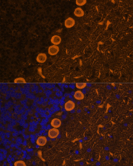 Immunofluorescence analysis of Rat brain cells using PRKCG Polyclonal Antibody at dilution of  1:100. Blue: DAPI for nuclear staining.