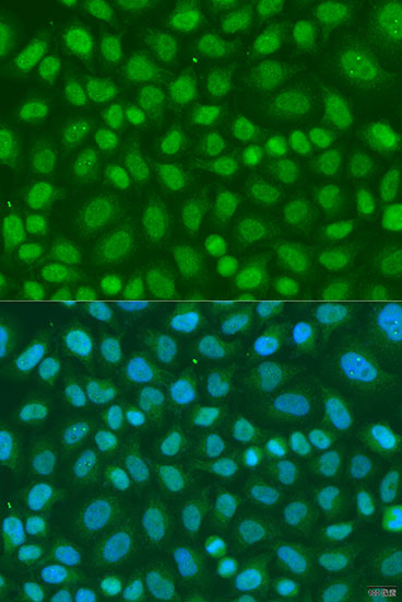 Immunofluorescence analysis of U2OS cells using TAF11 Polyclonal Antibody at dilution of  1:100. Blue: DAPI for nuclear staining.