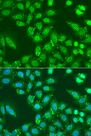 Immunofluorescence analysis of U2OS cells using HDAC4 Polyclonal Antibody at dilution of  1:100. Blue: DAPI for nuclear staining.