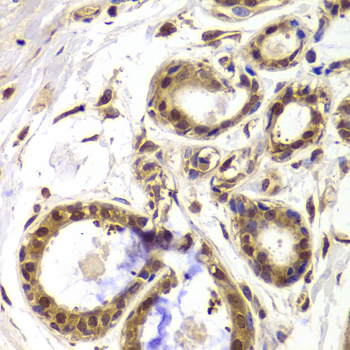 Immunohistochemistry of paraffin-embedded Human breast using HDAC4 Polyclonal Antibody at dilution of  1:100 (40x lens).