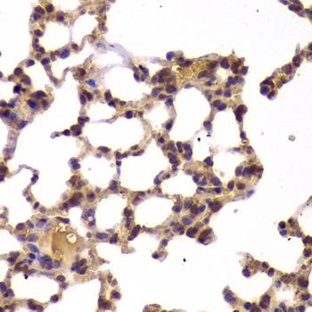 Immunohistochemistry of paraffin-embedded Mouse lung using HDAC4 Polyclonal Antibody at dilution of  1:100 (40x lens).