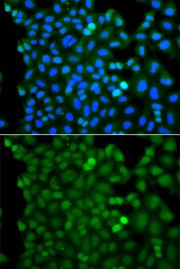 Immunofluorescence analysis of A549 cells using RNF125 Polyclonal Antibody