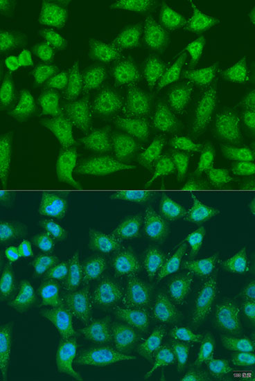 Immunofluorescence analysis of U2OS cells using EGLN3 Polyclonal Antibody at dilution of  1:100. Blue: DAPI for nuclear staining.