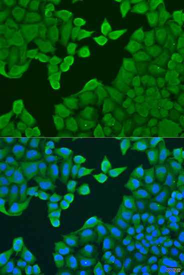 Immunofluorescence analysis of U2OS cells using ARF3 Polyclonal Antibody at dilution of  1:100. Blue: DAPI for nuclear staining.