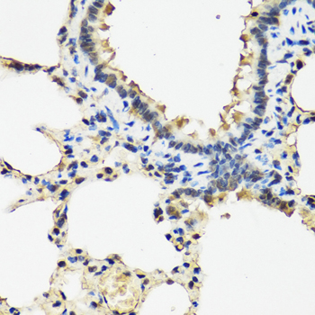 Immunohistochemistry of paraffin-embedded Rat lung using ARSF Polyclonal Antibody at dilution of  1:100 (40x lens).