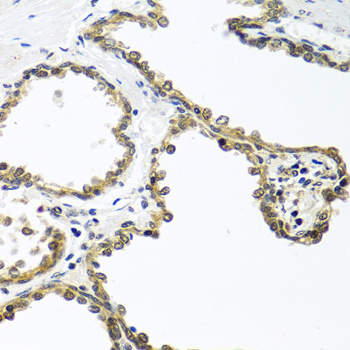 Immunohistochemistry of paraffin-embedded Human prostate using ARSF Polyclonal Antibody at dilution of  1:100 (40x lens).