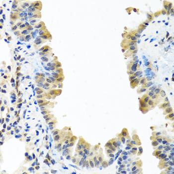 Immunohistochemistry of paraffin-embedded Mouse lung using ARSF Polyclonal Antibody at dilution of  1:100 (40x lens).