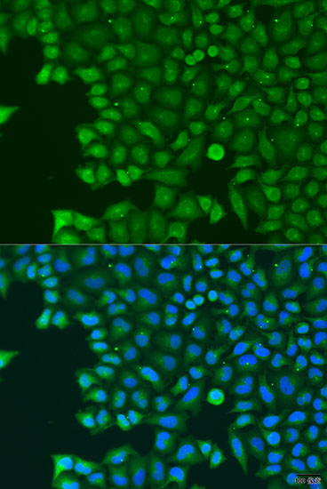 Immunofluorescence analysis of U2OS cells using ABCE1 Polyclonal Antibody at dilution of  1:100. Blue: DAPI for nuclear staining.