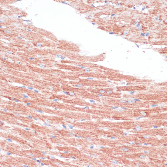 Immunohistochemistry of paraffin-embedded Mouse heart using FZD4 Polyclonal Antibody at dilution of  1:100 (40x lens).