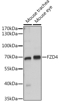 Western blot analysis of extracts of various cell lines using FZD4 Polyclonal Antibody at dilution of 1:1000.