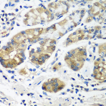 Immunohistochemistry of paraffin-embedded Human stomach using STX16 Polyclonal Antibody at dilution of  1:100 (40x lens).