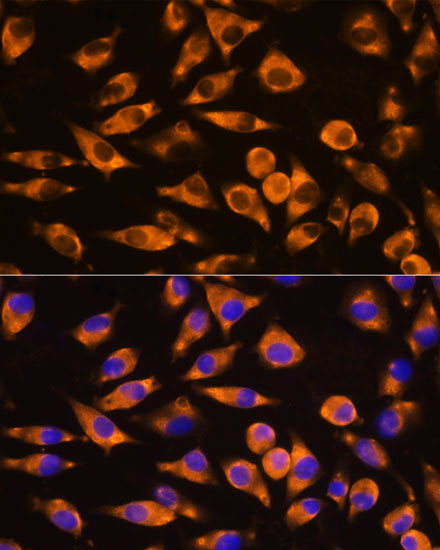 Immunofluorescence analysis of L929 cells using CEP55 Polyclonal Antibody at dilution of  1:100. Blue: DAPI for nuclear staining.
