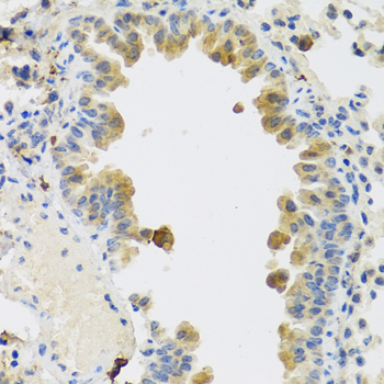 Immunohistochemistry of paraffin-embedded Mouse lung using RSPO1 Polyclonal Antibody at dilution of  1:100 (40x lens).