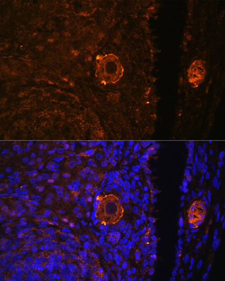 Immunofluorescence analysis of Rat oophoroma cells using ZP3 Polyclonal Antibody at dilution of  1:100. Blue: DAPI for nuclear staining.