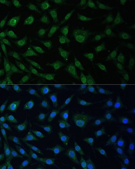 Immunofluorescence analysis of L929 cells using NUP214 Polyclonal Antibody at dilution of  1:100 (40x lens). Blue: DAPI for nuclear staining.