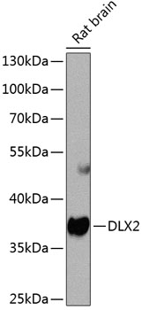 Western blot analysis of extracts of Rat brain using DLX2 Polyclonal Antibody at dilution of 1:1000.