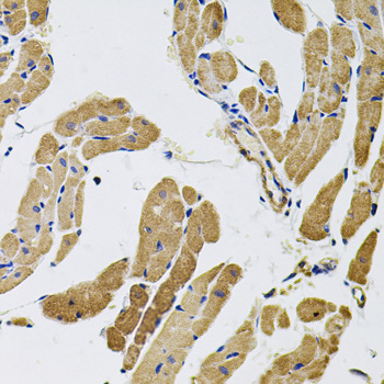 Immunohistochemistry of paraffin-embedded Rat heart using MYO10 Polyclonal Antibody