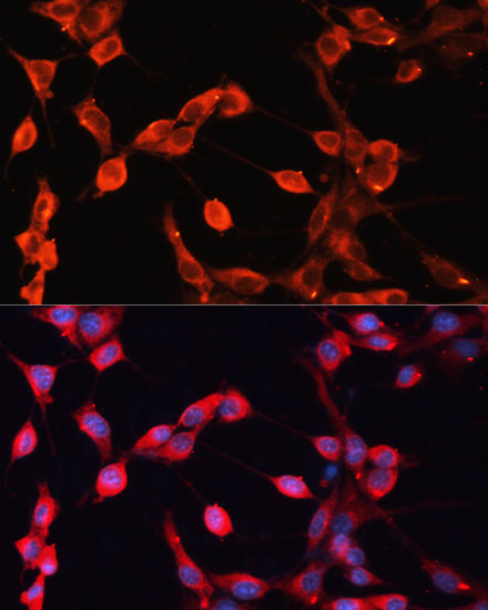 Immunofluorescence analysis of NIH-3T3 cells using ADAMTS13 Polyclonal Antibody at dilution of  1:100 (40x lens). Blue: DAPI for nuclear staining.