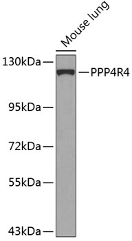 Western blot analysis of extracts of Mouse lung using PPP4R4 Polyclonal Antibody at dilution of 1:1000.